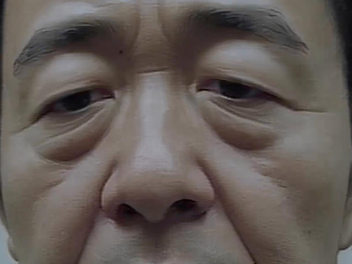 两眼之间鼻梁凹陷面相好吗